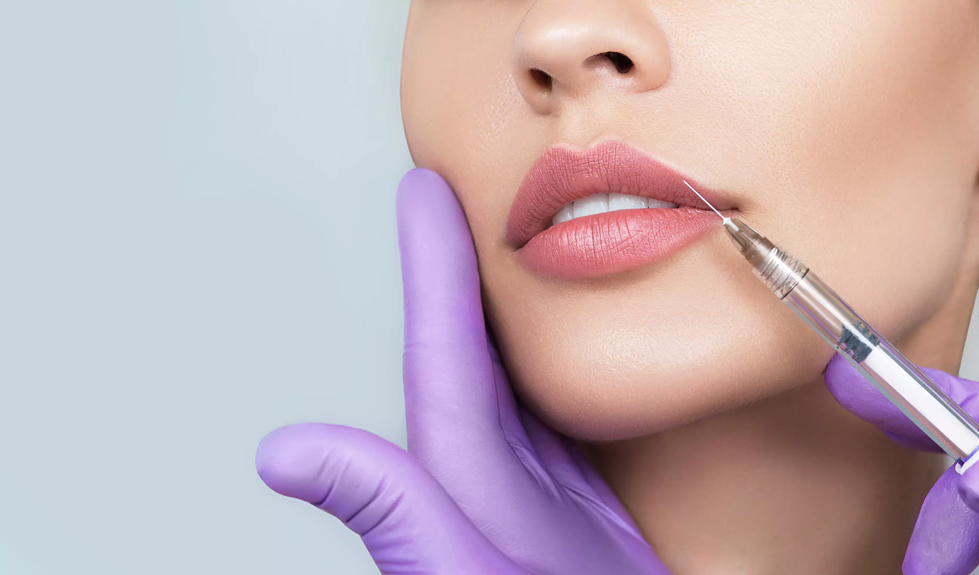 Before and After Fillers